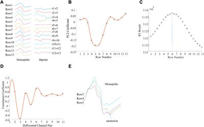 Muscle innervation zone estimation from monopolar high-density M-waves using principal component analysis and radon transform